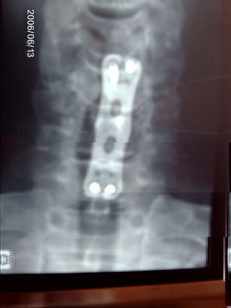 IMAG0293.JPG
